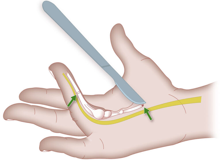 Handchirurgie Warendorf - Chirurgische Gemeinschaftspraxis Warendorf
